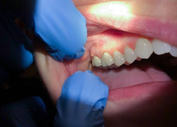 Best Pediatric Emergency Dentist in Grant, AL